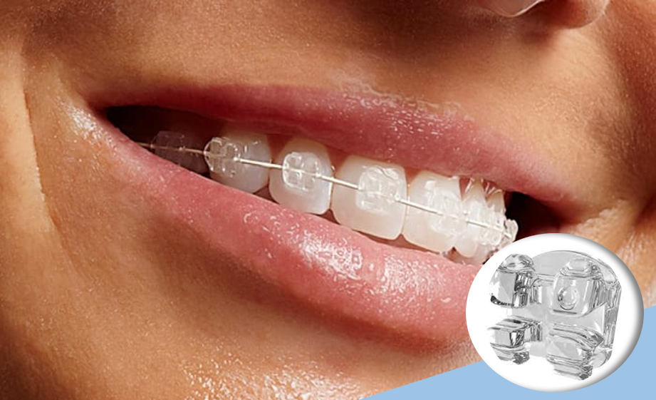 brackets-zafiro-trasparentes