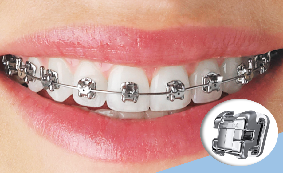 brackets-autoligado